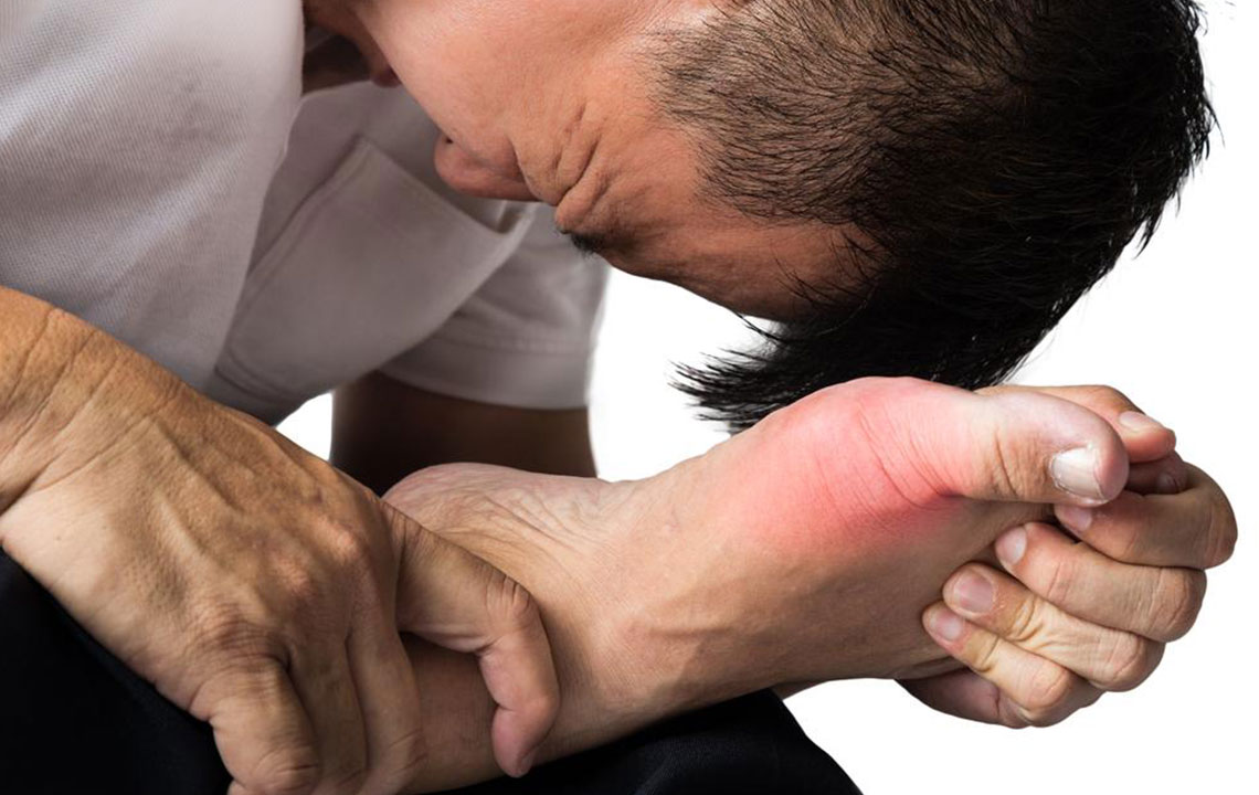 5 Effective Treatments for Gout