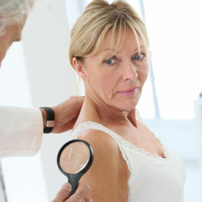Best Treatment Options to Get Relief from Shingles