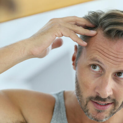 10 Effective Home Remedies to Stop Hair loss