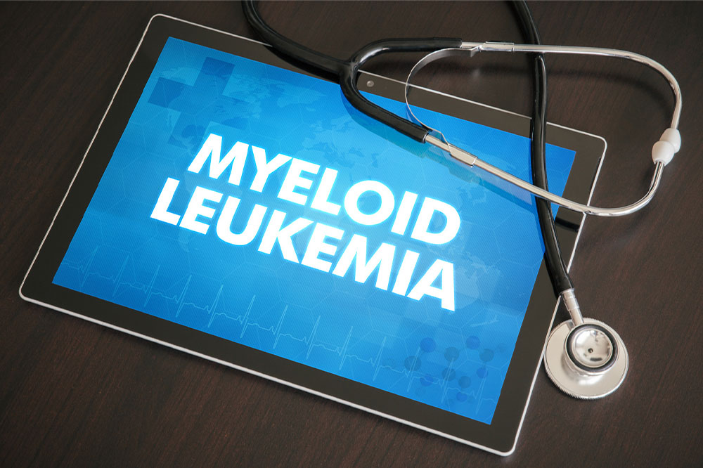 5 signs that indicate myeloid leukemia