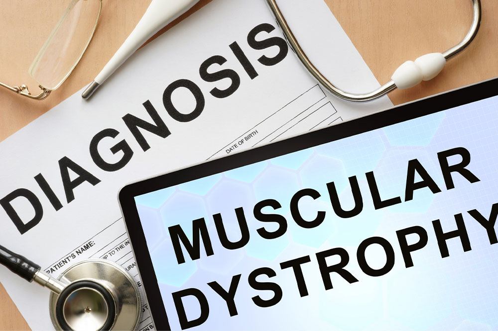 Common signs of muscular dystrophy