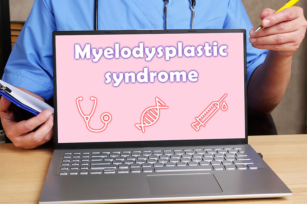 Top 3 management methods for myelodysplastic syndromes